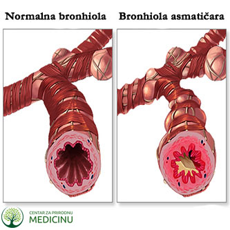 bronhiole2-2016.jpg